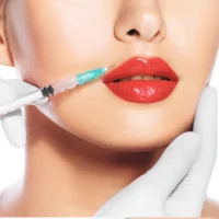 Lip Augmentation