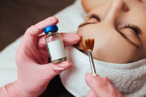 Advanced TCA Chemical Peel Training Course