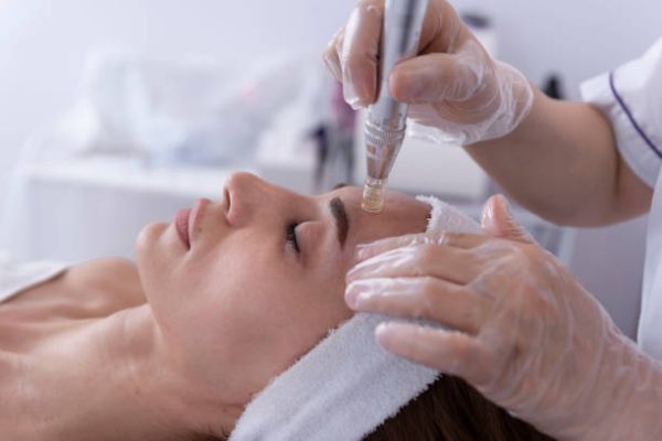 Microneedling Training Course